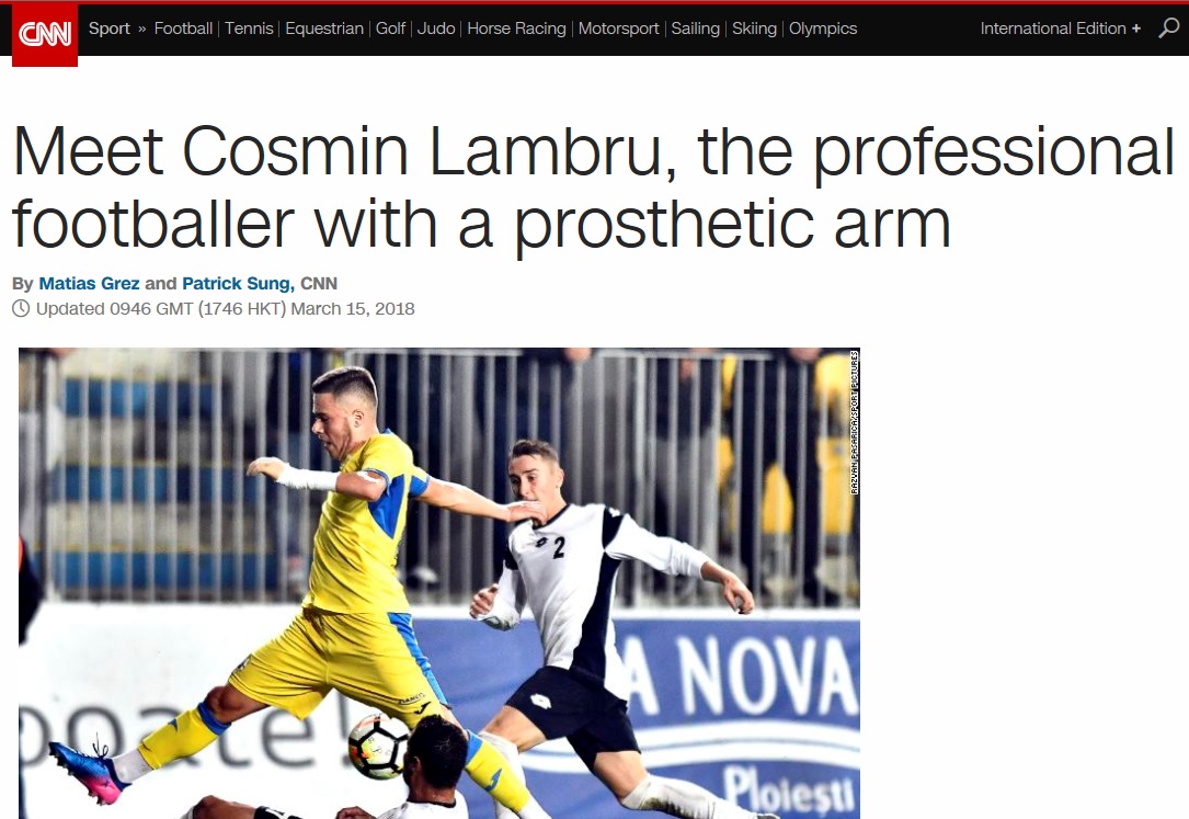  '의수를 착용한 축구선수' 람브루의 소식을 전하는 CNN