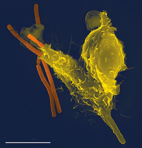 백혈구의 일종인 호중구(노란색)가 세균(주황색)을 포식하고 있는 모습. 면역체계는 인체와 미생물의 공생 혹은 침투 저지 등에 지대한 영향을 끼친다.  