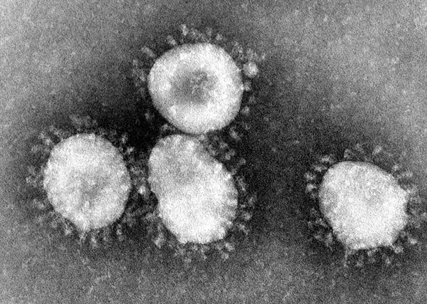 코로나바이러스 전자현미경 사진. 주변이 왕관처럼 생겼다 해서 코로나바이러스라고 불린다. 코로나는 라틴어로 왕관이라는 의미이다. 