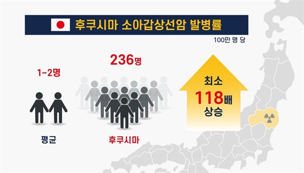 2020년 2월 후쿠시마 소아갑상선암 발병률