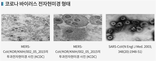 전자현미경으로 본 코로나바이러스