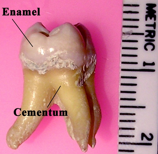 어금니 뼈. 윗쪽으로 하얗게 빛나는 부분이 에나멜층이다. 치아는 인체의 여러 부분 가운데 강도가 단연 강해서 수천년 된 유골 등에서 마지막까지 남는 경우가 많다. 