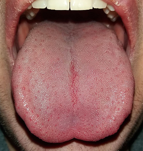 사람의 혀. 맛은 혀에서 주로 느끼지만, 뺨의 입안 쪽 부위, 기관지 상부 부위 등에도 맛세포가 존재한다. 