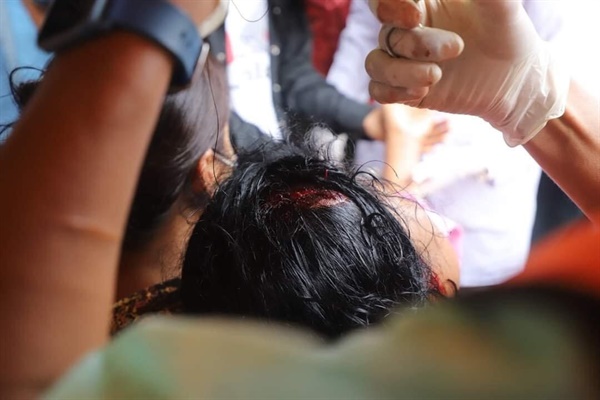 2월 20일 미얀마 만달레이에서 벌어진 시위자의 부상과 연행 상황.