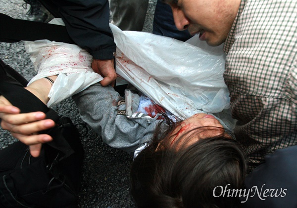 1일 새벽 광화문앞에서 경찰이 강제진압을 하던 도중 한 여성이 얼굴에서 많은 피를 흘리며 쓰러져 있다.