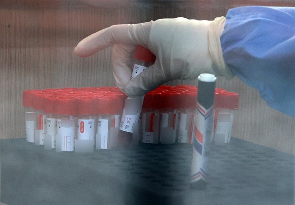 25일 오전 서울 중구 서울역 광장에 마련된 신종 코로나바이러스 감염증(코로나19) 임시 선별검사소에서 검사소 관계자가 접수된 검체를 보관대에 놓고 있다. 