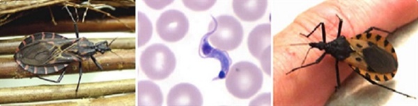 샤가스병 매개체가 되는 침노린재와 사람 혈액 속에서 관찰된 '크루즈 파동편모충'의 모습