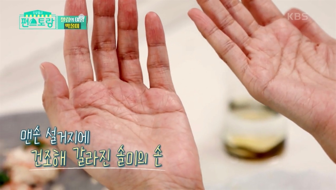  KBS2 <신상출시 편스토랑> 104회에 출연한 배우 박솔미의 손 모습