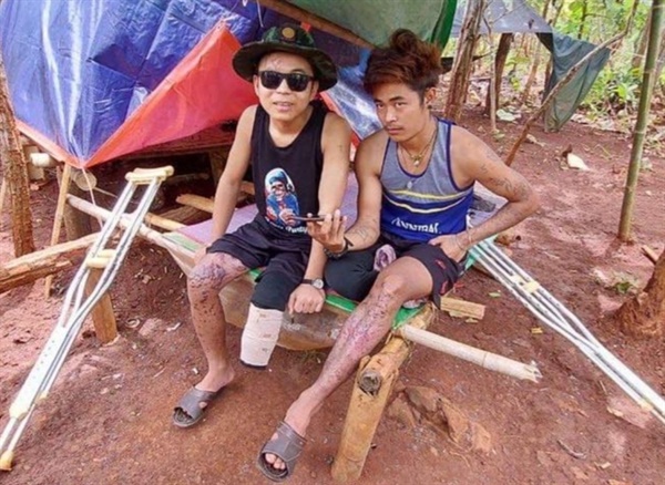 2022년 4월 카레니(Karenni)주에서 대인지뢰를 밟고 다리를 잃은 소수민족 청년들