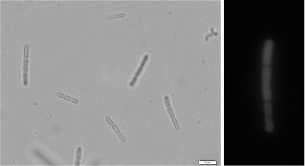 자생 미세조류 슈드아나배나 뮤시콜라 지오0704(Pseudanabaena mucicola GO0704)의 형태: 광학현미경(좌), 형광현미경(우)