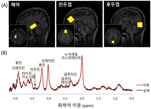 (A) 스펙트럼을 측정한 뇌 부위(노란색 박스)와 (B) 해마에서의 1H MR 스펙트럼_해마의 타우린 신호는 3.4 ppm 위치(화살표)에서 확인할 수 있다. 검은색 선은 실제 측정한 스펙트럼이고, 붉은색은 측정 데이터에 대한 LCModel 피팅 스펙트럼이다.