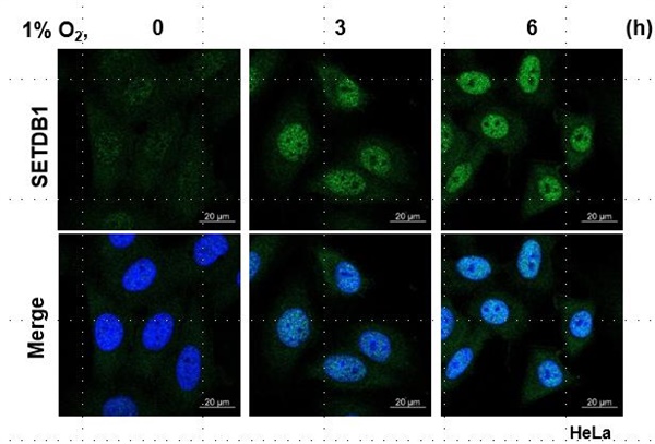 암세포주 HeLa에서 저산소 환경에 노출된 시간이 늘어날수록 SETDB1이 증가함을 SETDB1 항체(위)와 청색 형광(아래)을 통해 확인됐다.