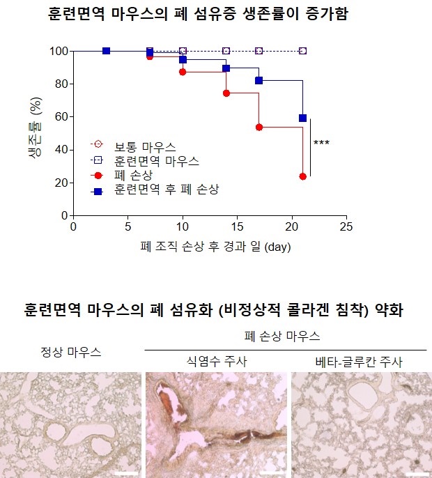 베타-글루칸으로 유도한 훈련면역이 마우스의 폐 섬유증 완화 (상단) 블레오마이신 유도 폐섬유화 마우스의 생존률 비교. 일반 마우스 12마리, 훈련면역 마우스, 폐 손상 마우스, 훈련면역 후 폐손상 마우스 각각 18마리. ***P < 0.0001 log-rank test. (하단) 시리우스 레드(Sirius Red) 염색을 통한 폐 절편의 콜라겐 침착물 가시화. 콜라겐(적색) 및 근섬유(황색) 스케일 바 = 100 μm.  // 그림설명 및 그림제공 : 울산의대 최은영 교수